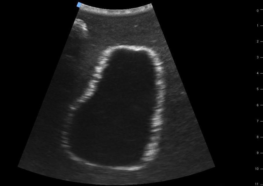 SonoEZ-ultrasound-trainer-"Urinary-bladder"-7