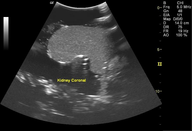Adult-Torso-for-X-Ray-CT-and-US-10 Adult-Torso-for-X-Ray-CT-and-US-10