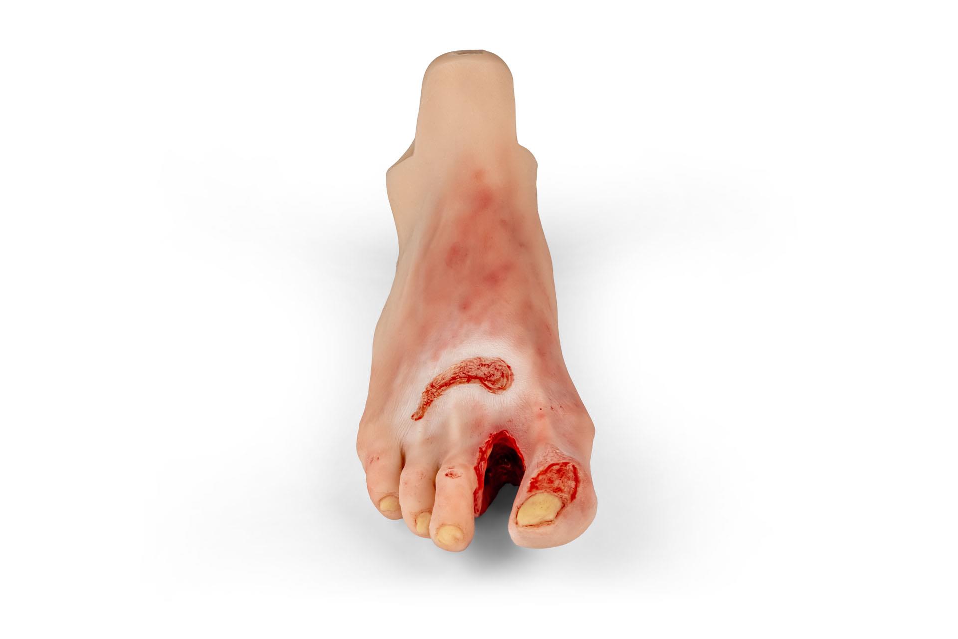 Wound-foot-with-diabetic-foot-syndrome-severe-stage-manikin-version-1