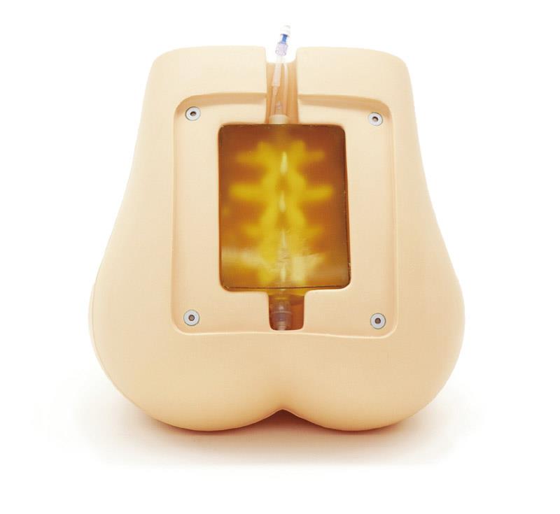 Ultrasound Compatible Lumbar Puncture / Epidural Simulator