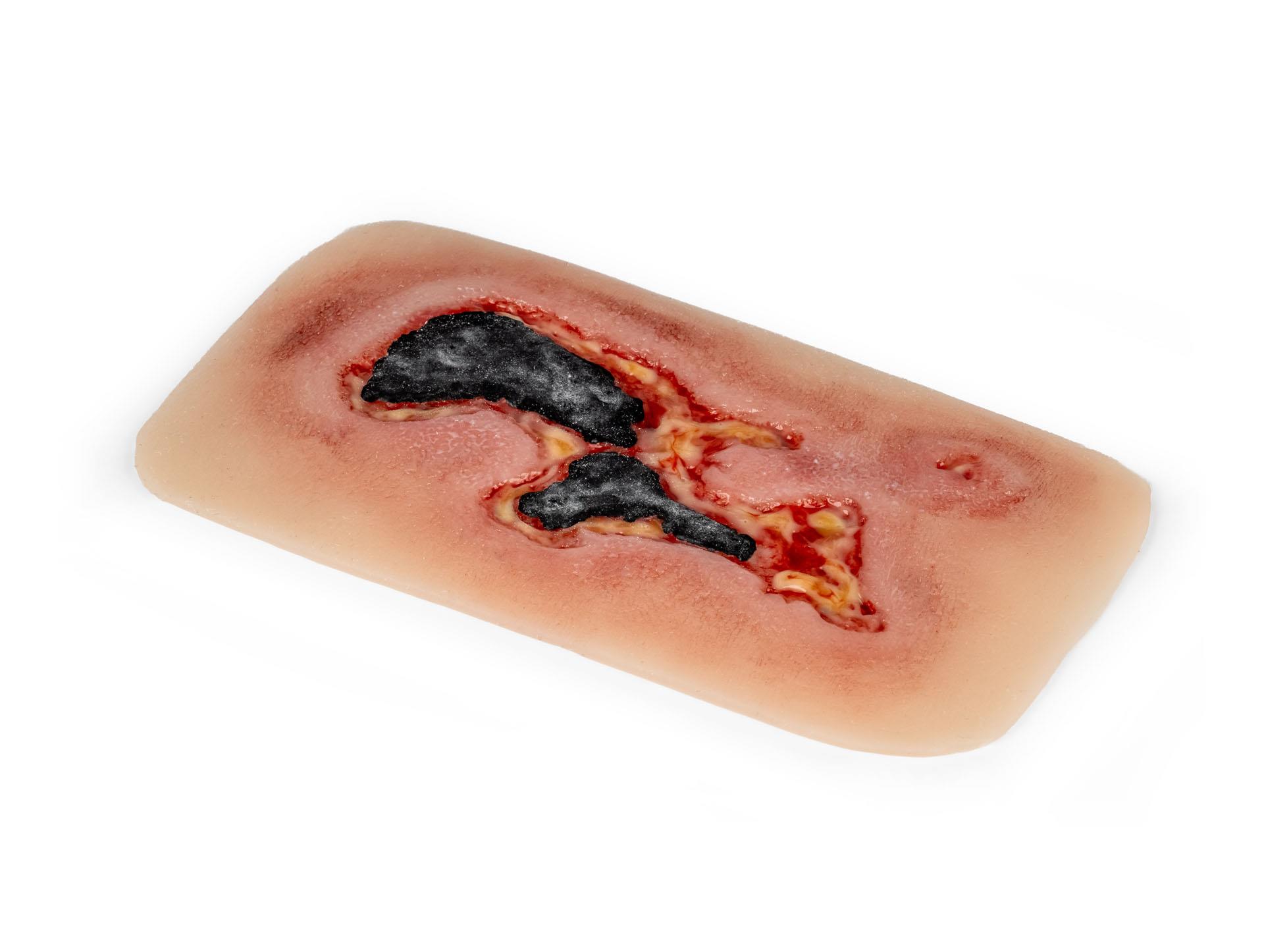 Wound-moulage-arterial-leg-ulcer-small-exudation-phase-3