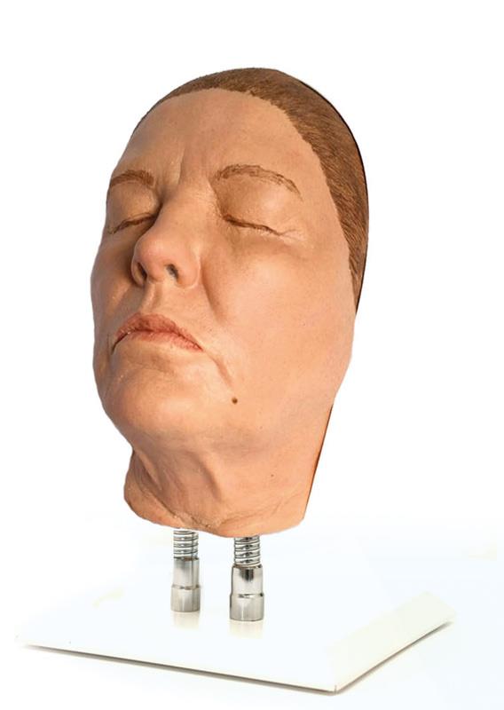 Head for facial injections, version G