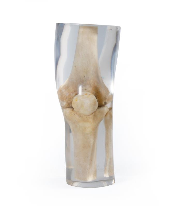 X-Ray Phantom Knee, transparent