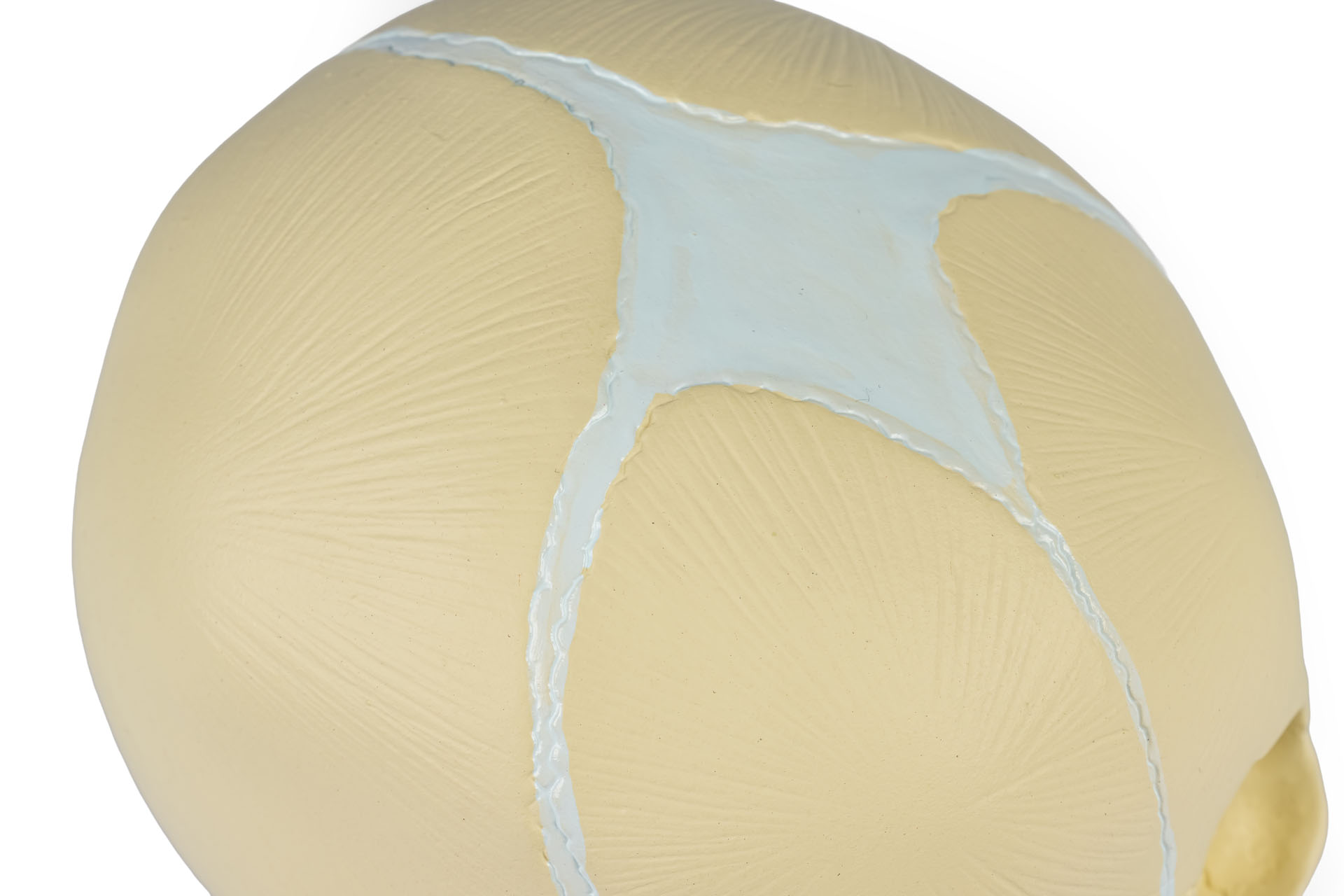  Crane d´une foetus 30ièmesemaine 