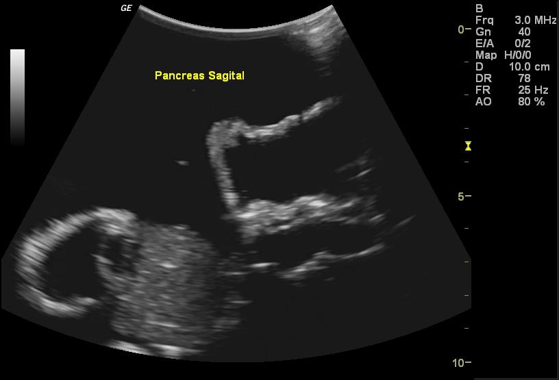 Adult-Torso-for-X-Ray-CT-and-US-5 Adult-Torso-for-X-Ray-CT-and-US-5
