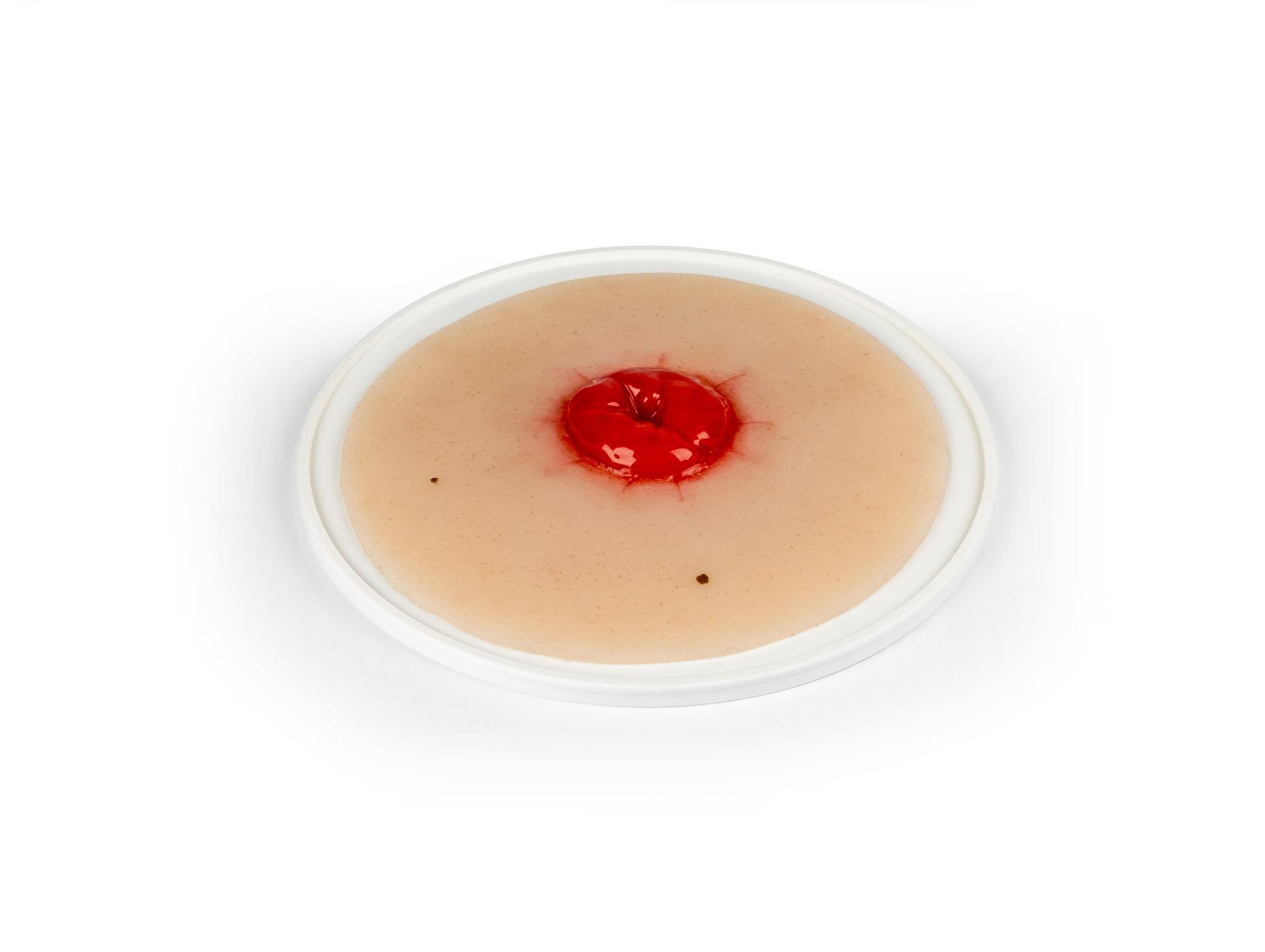Wound-moulage-colostomy-self-adhesive