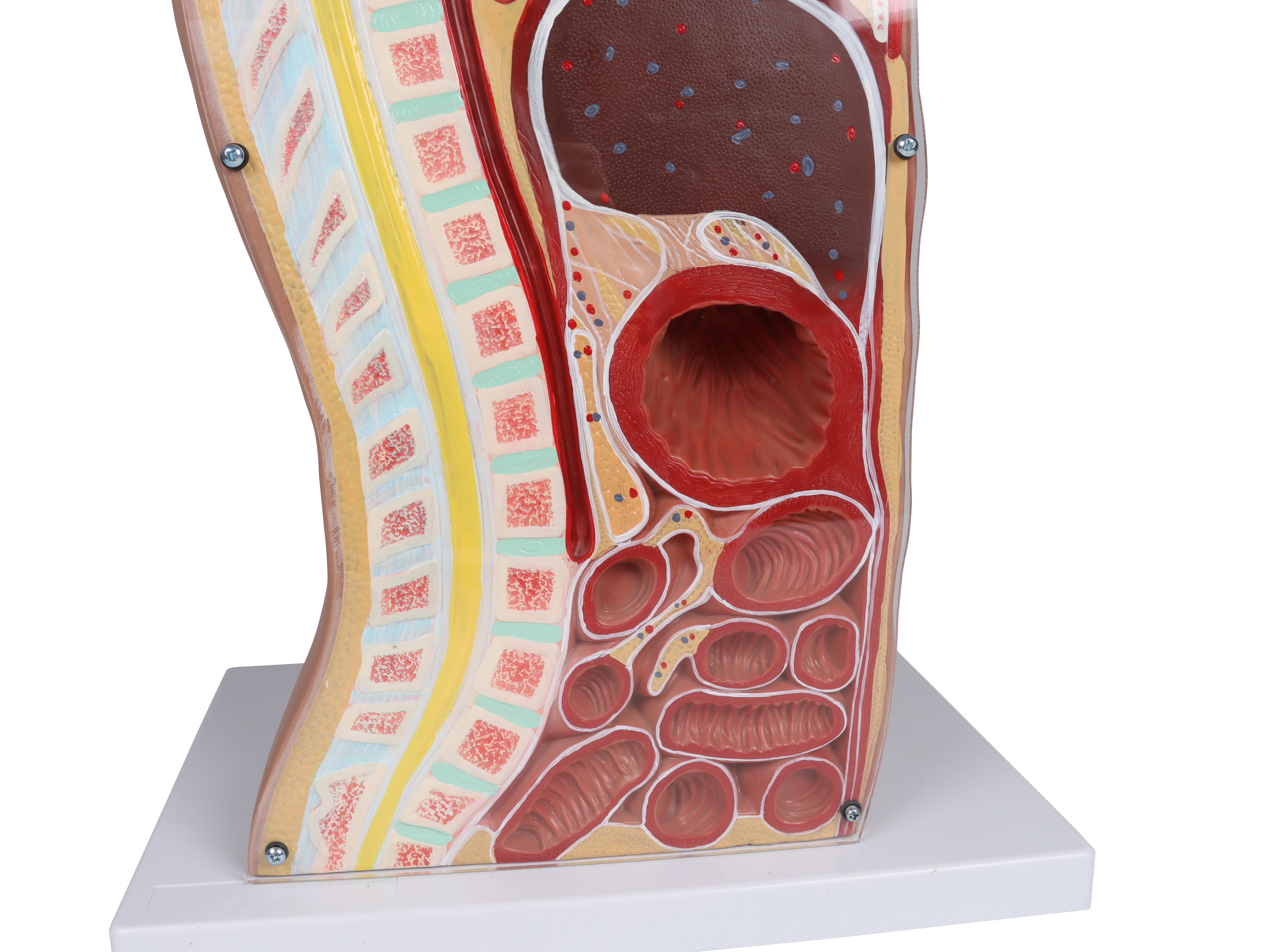 NG-&-Tracheostomie-Torso-lebensgroß-5