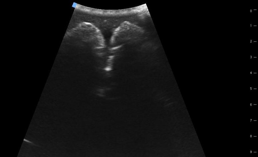 SonoEZ-ultrasound-trainer-"Urinary-bladder"-5