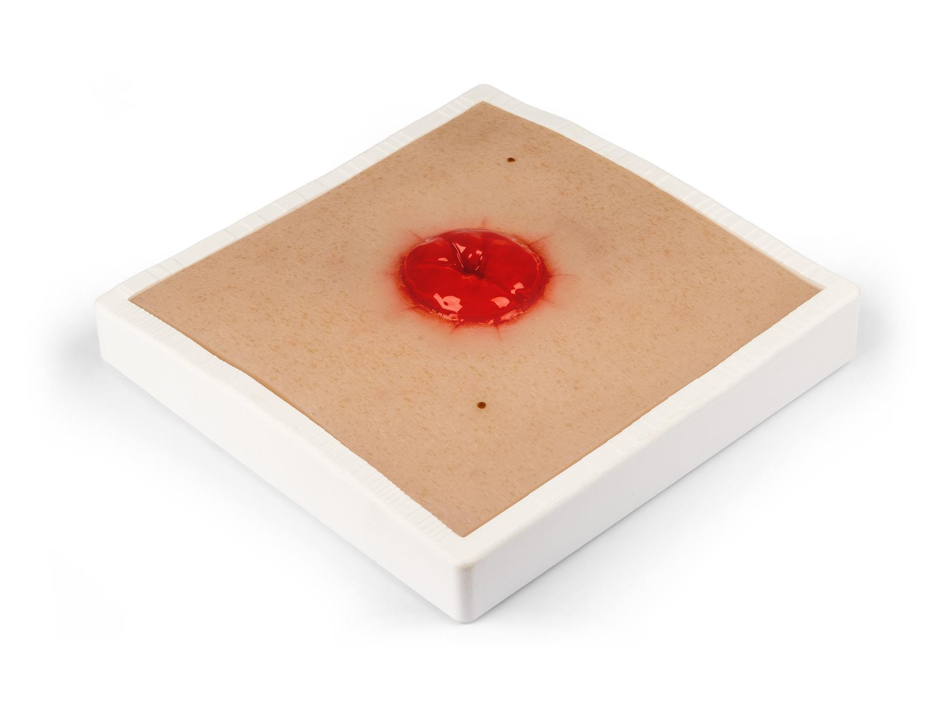 Wound-Moulage-Colostoma-incl-stand