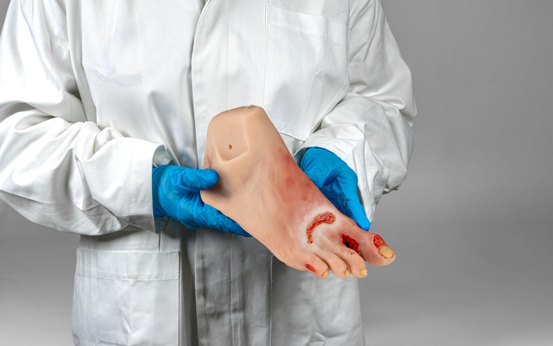 Wound-foot-with-diabetic-foot-syndrome-severe-stage-manikin-version-9