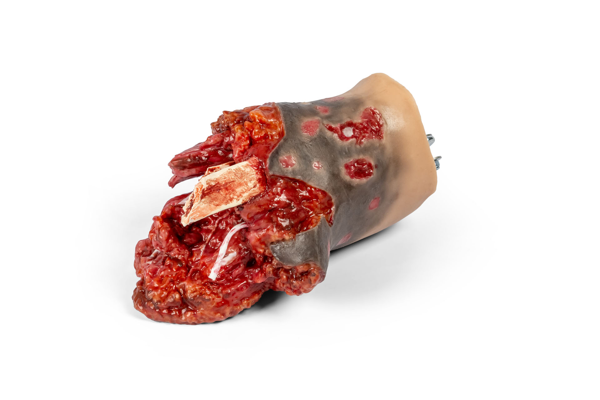 Amputationsstumpf Bein rechts, Combat Carl