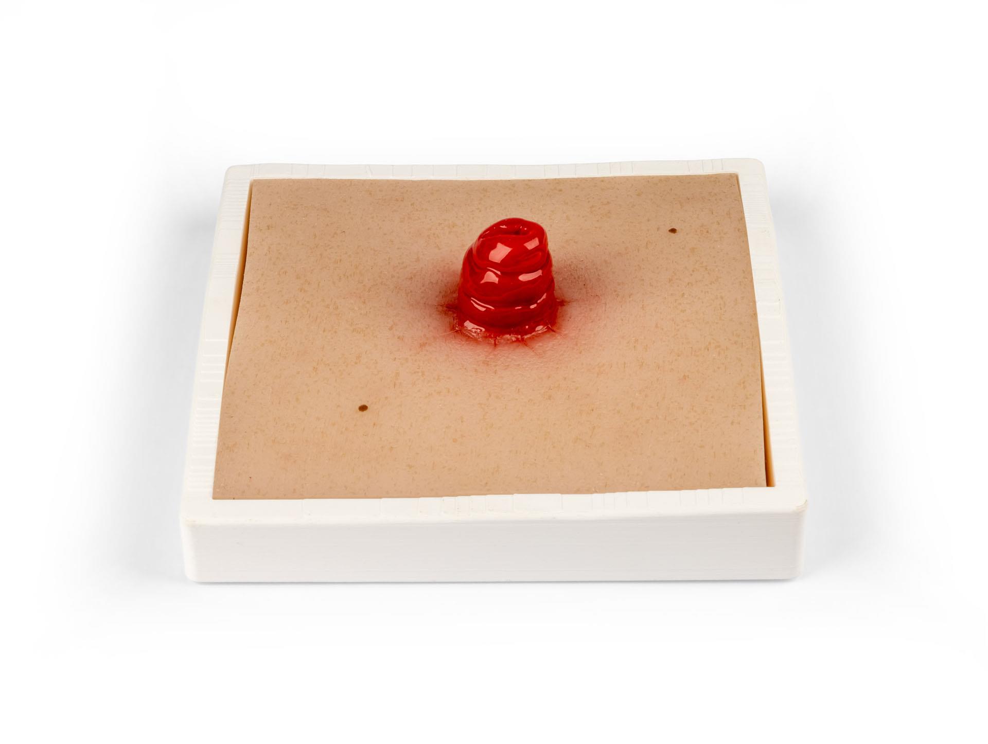 Wound-Moulage-Ileostoma-incl-stand-1