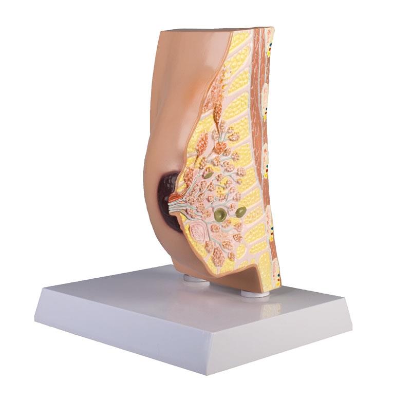 Breast cross section with diseases