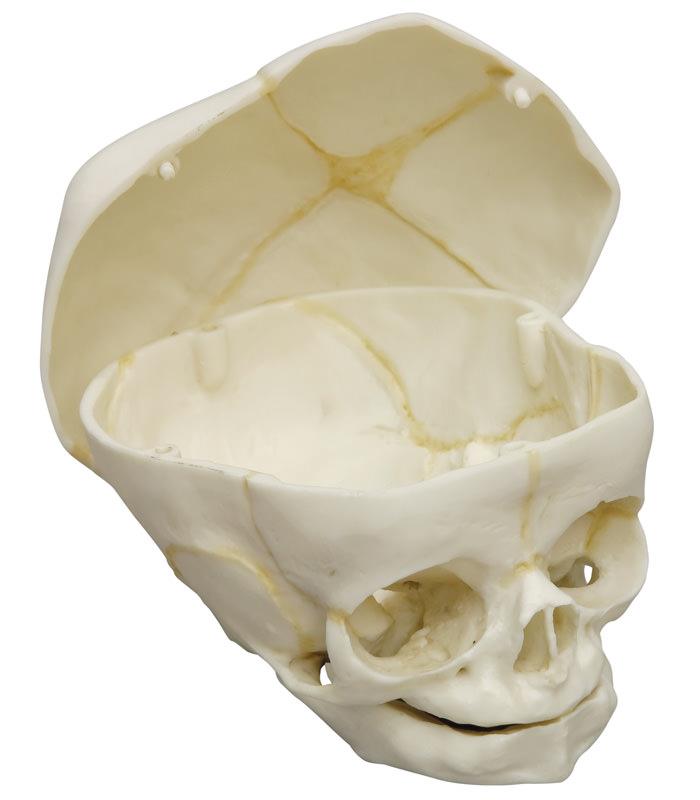 Crâne d´un fœtus, 40ième semaine, toit démontable