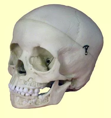 Skull, 5 year old, open jaw