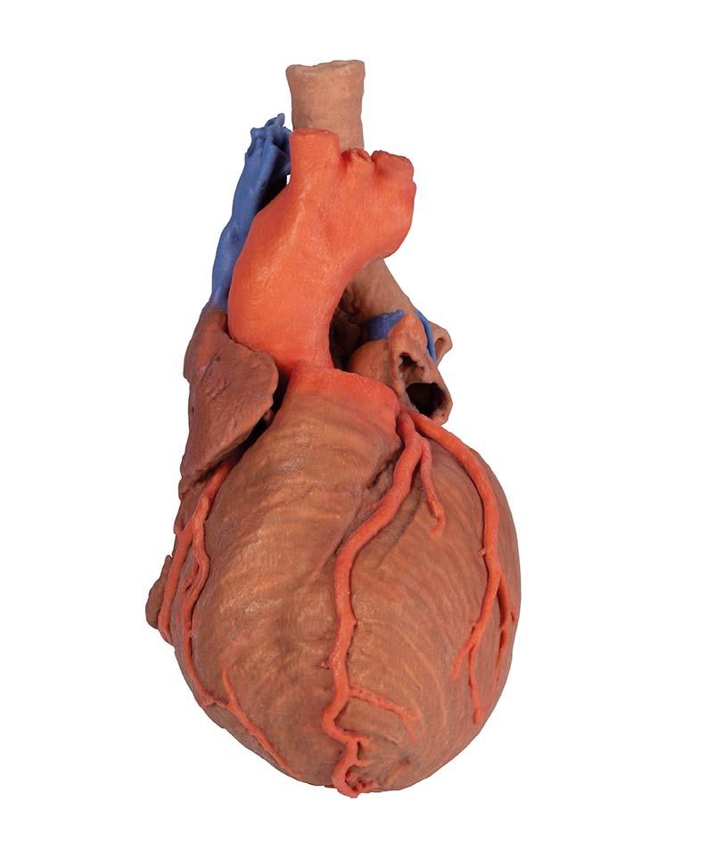 Herz und distale Trachea, Carina tracheae und Primärbronchien