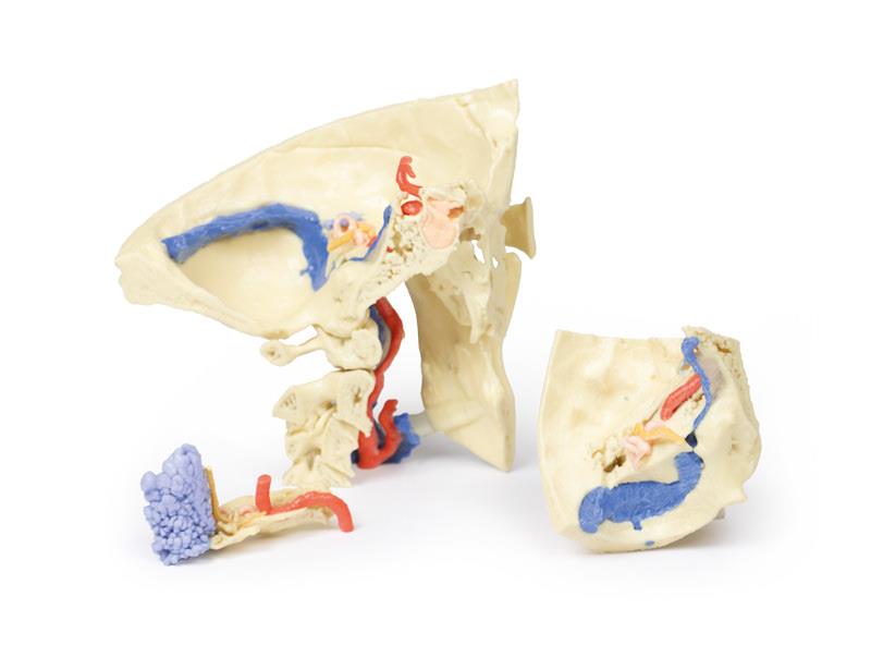 Temporal Bone Model, Set of 3