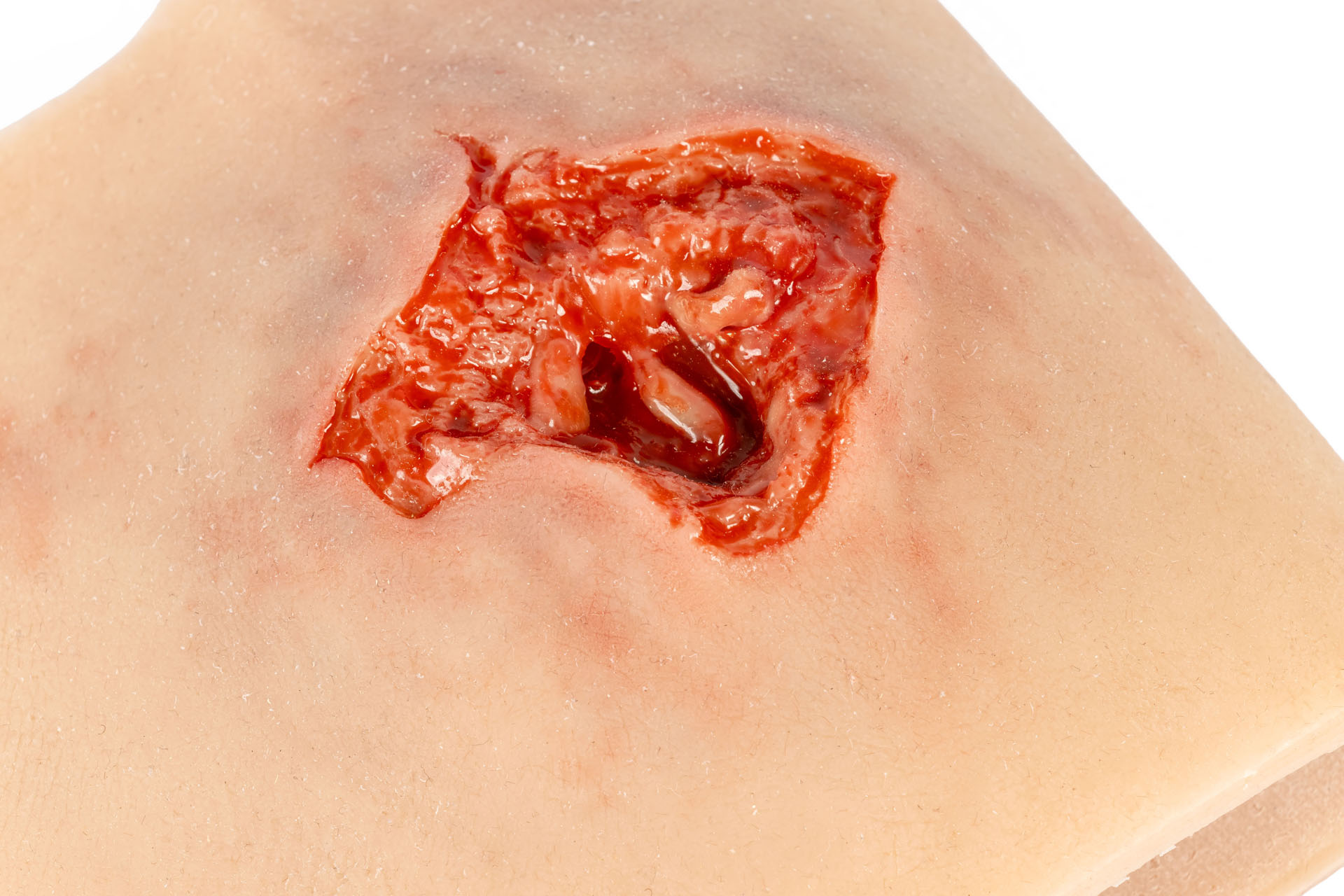 Wound Simulation Sleeve: Arm Gunshot Wound with Bleeding Function