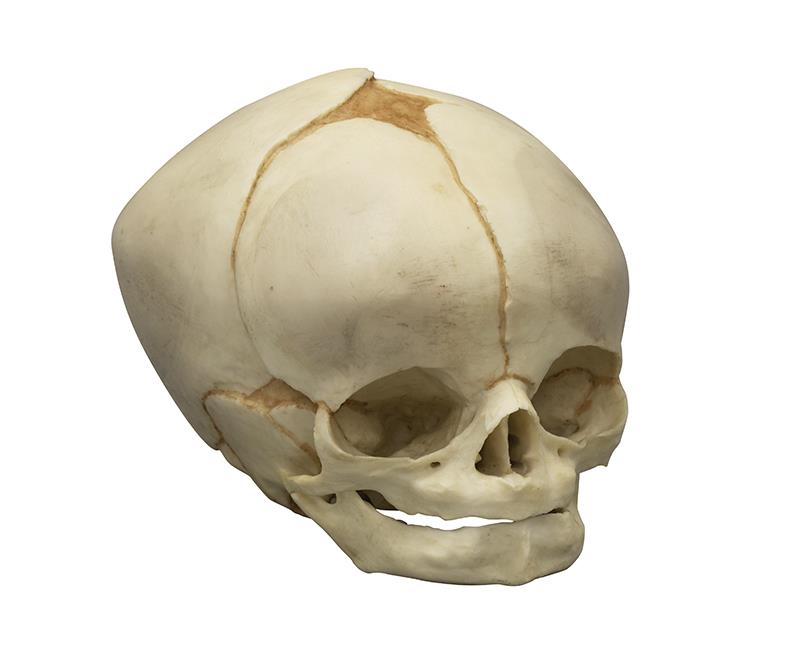 Fetal skull 40 ½ weeks