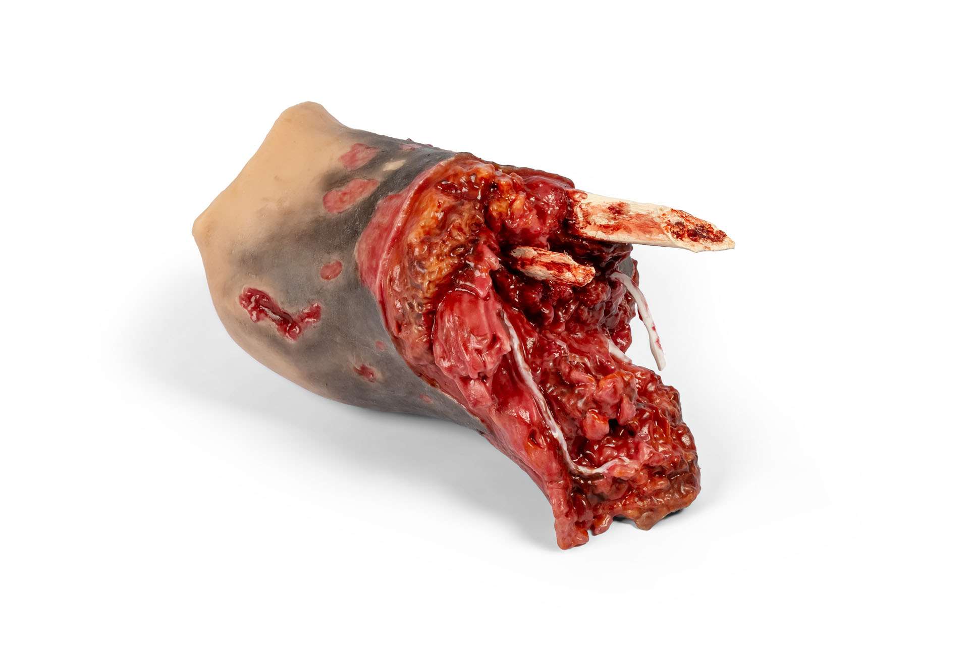 Amputationsstumpf Bein rechts, Combat Carl