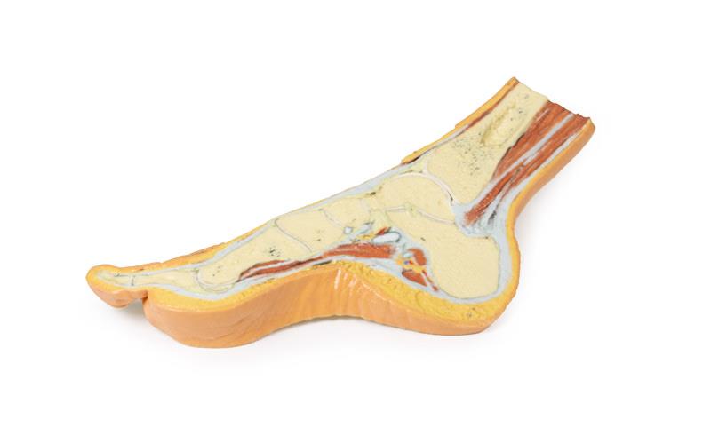 Fuß – Parasagittaler Querschnitt
