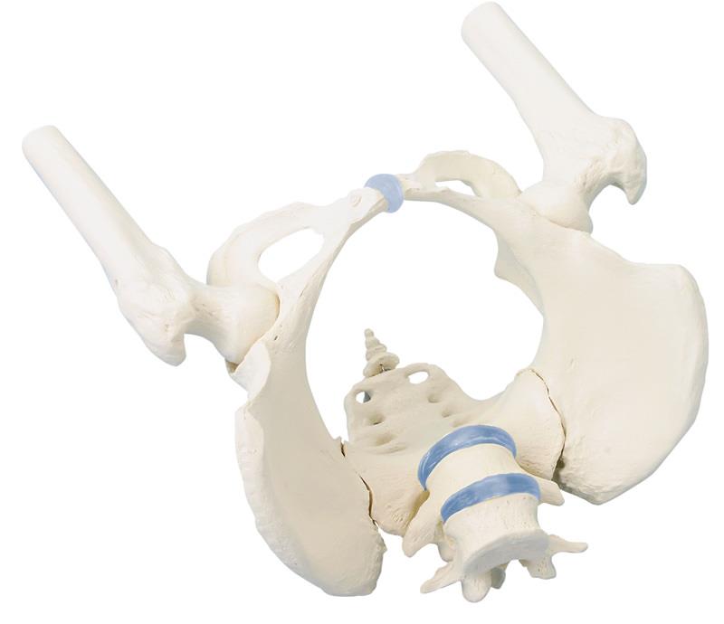 Female pelvis with sacrum, 2 lumbar vertebrae and femoral stumps