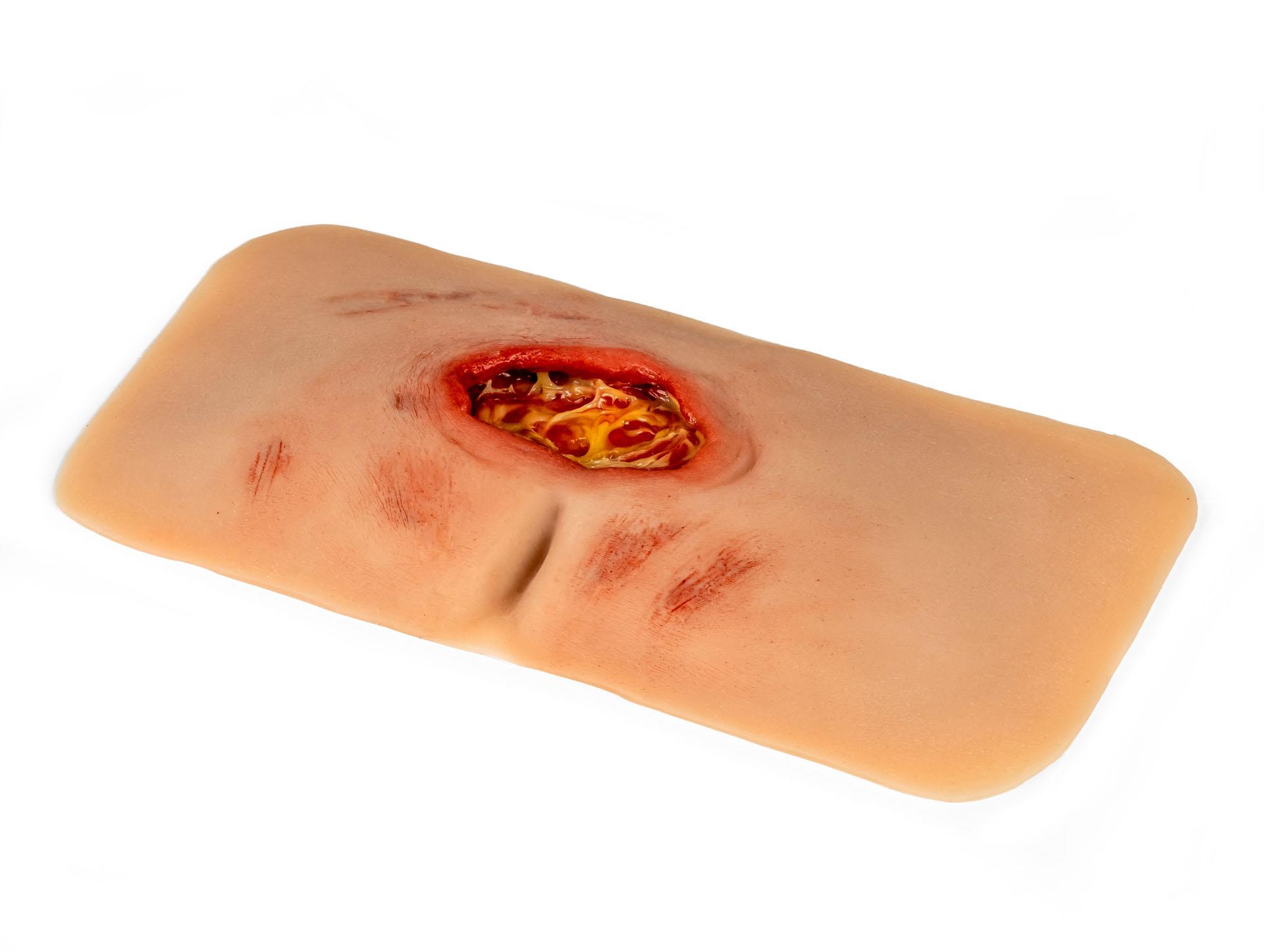 Wound-moulage-sacral-decubitus-cleaned-3