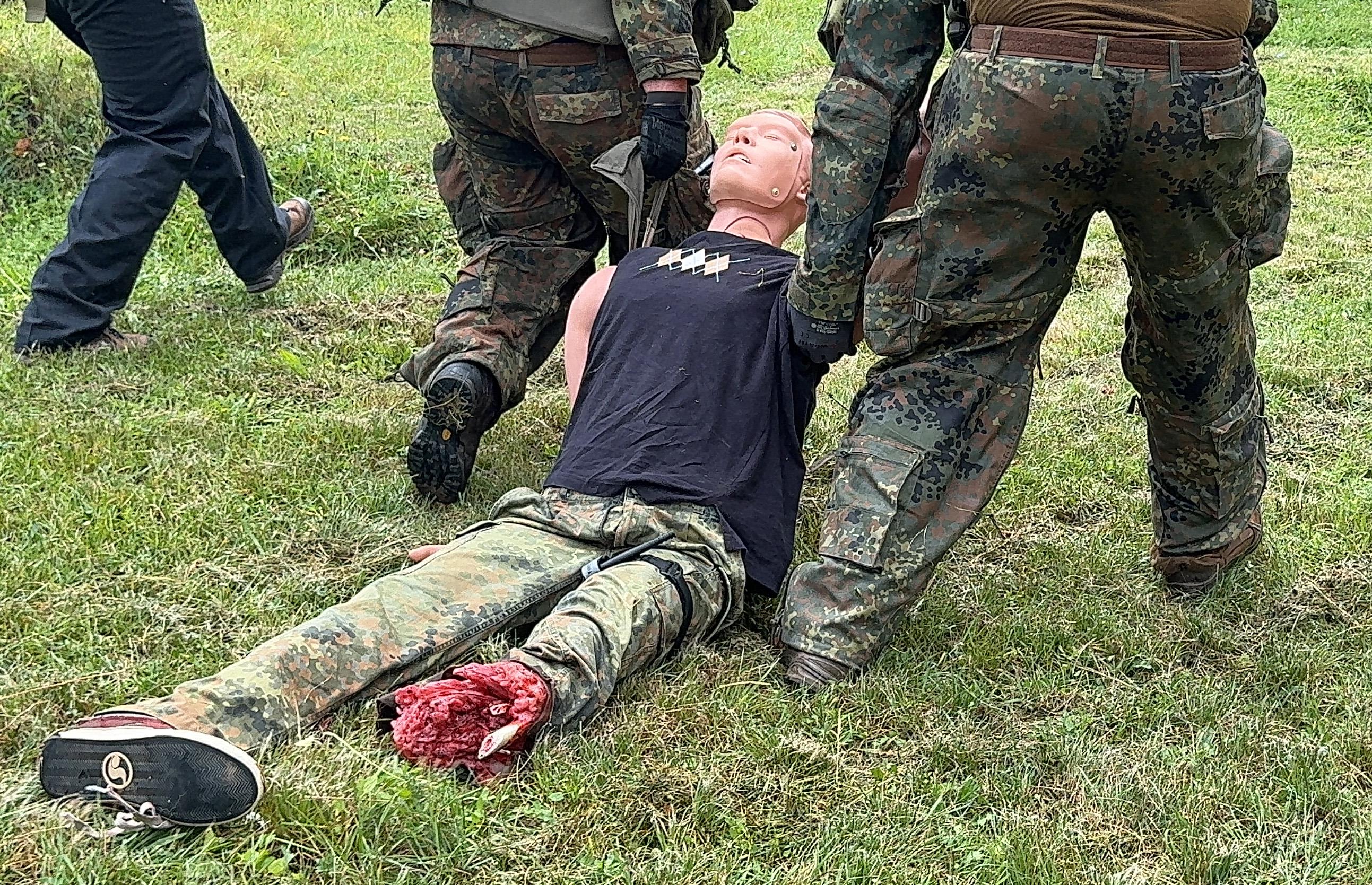 Right-amputation-stump-for-Combat-Carl-8