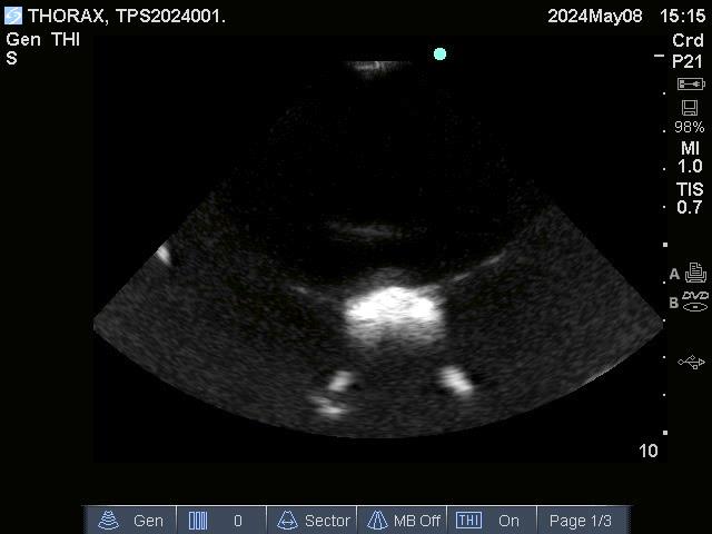Adult-Thorax-for-X-Ray-CT-and-US-5 Adult-Thorax-for-X-Ray-CT-and-US-5