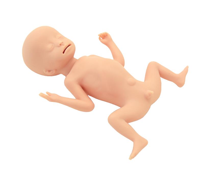 Infant with extremely low birth weight (ELBW)