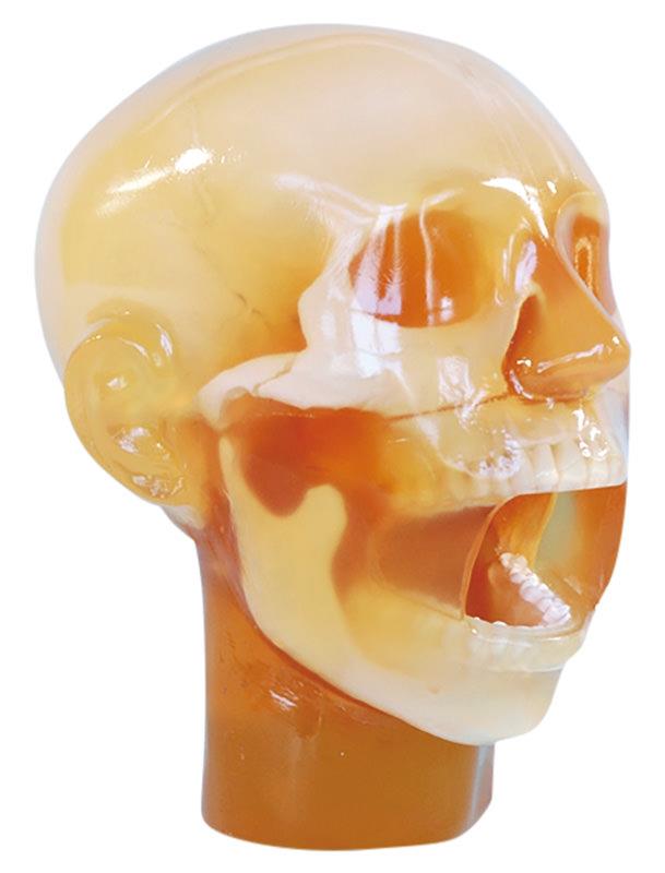 Dental x-ray head with open mouth
