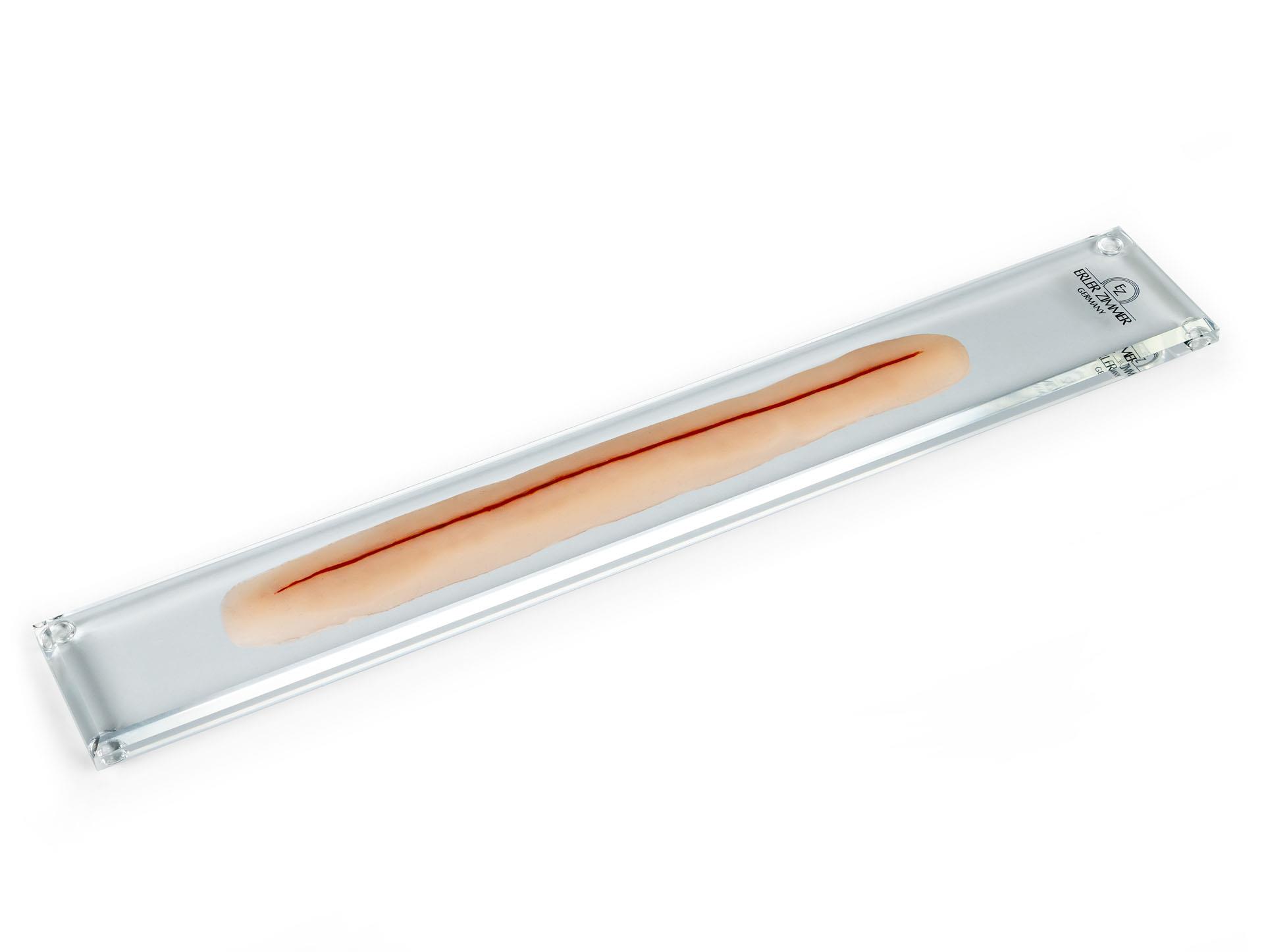 OP-Wunde-ohne-Naht-22cm