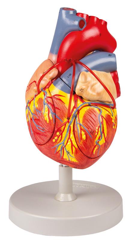 Heart with Bypass, 2x life size, 4 parts