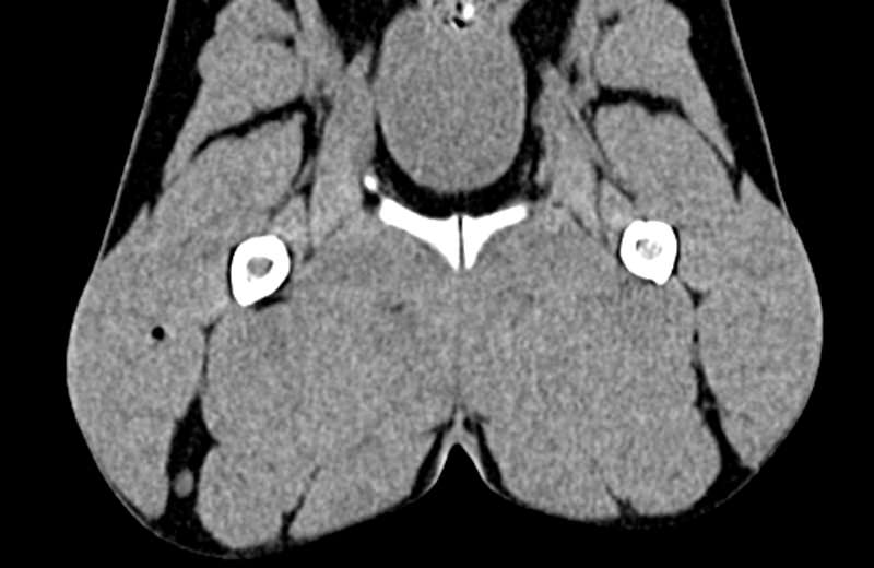 Dog-pelvis-phantom-for-CT-and-x-ray-3