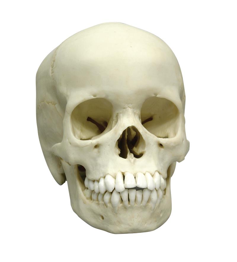 Human Skull, 13 year old